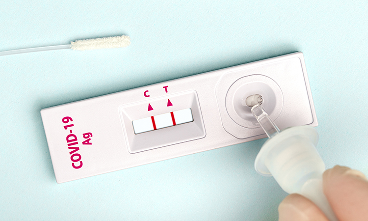 IATA urges governments to accept rapid antigen tests to fulfil requirements